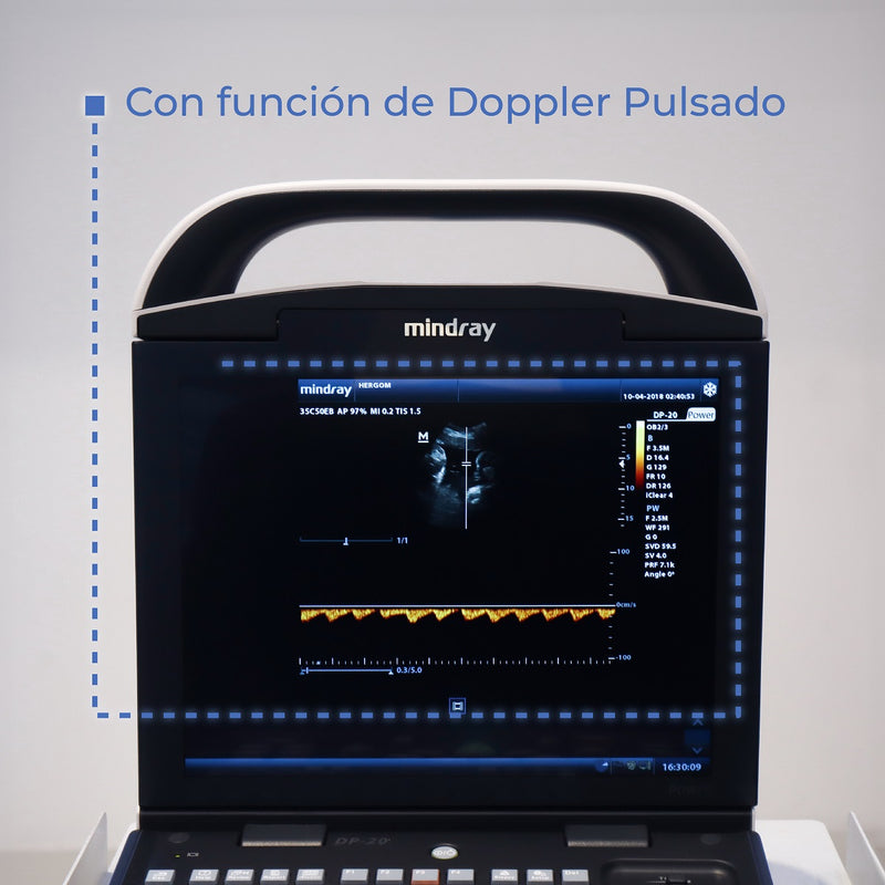 Ultrasonido Portátil para Uso Humano DP20 con Transductor Convexo y Lineal - DP20 Marca Mindray