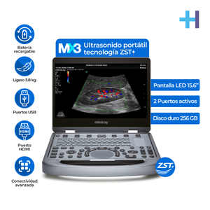 Ultrasonido Portátil MX3 Mindray con Tecnología ZST+ | Ecógrafo Profesional de Diagnóstico | Mindray