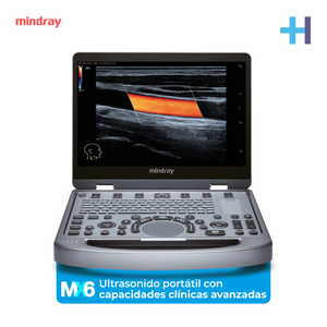 Ultrasonido Portátil MX6 con Tecnología ZST+ | Ecógrafo Profesional con Doppler y 3D/4D | Mindray