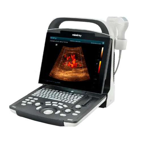 Ultrasonido Portátil para Uso Humano DP20 con función Doppler Pulsado y mejoradores de imagen iBeam y iClear - Marca Mindray
