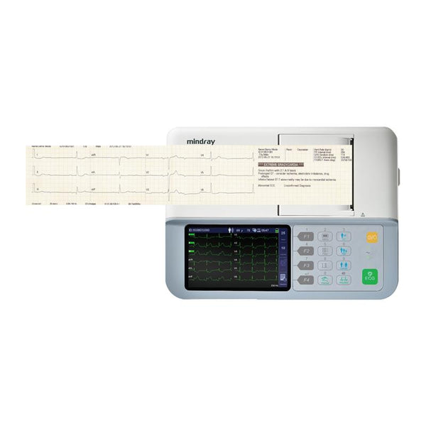 Electrocardiógrafo Portátil de 3 Canales, Pantalla 5 Pulgadas y